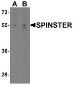 SPNS1 Antibody in Western Blot (WB)