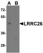 LRRC26 Antibody in Western Blot (WB)