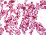 SFTPA1/SFTPA2 Antibody in Immunohistochemistry (Paraffin) (IHC (P))