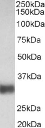 SFTPA1/SFTPA2 Antibody in Western Blot (WB)