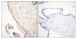 Phospho-B-Raf (Ser602) Antibody in Immunohistochemistry (Paraffin) (IHC (P))