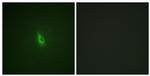 Phospho-IP3 Receptor 1 (Ser1588, Ser1598) Antibody in Immunocytochemistry (ICC/IF)