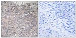 Phospho-IP3 Receptor 1 (Ser1588, Ser1598) Antibody in Immunohistochemistry (Paraffin) (IHC (P))