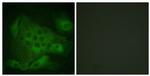 Phospho-PIKFYVE (Ser307) Antibody in Immunocytochemistry (ICC/IF)