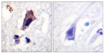 Phospho-PIKFYVE (Ser307) Antibody in Immunohistochemistry (Paraffin) (IHC (P))