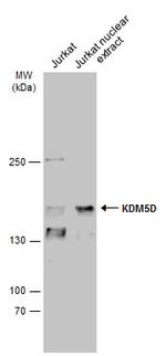 KDM5D Antibody in Western Blot (WB)