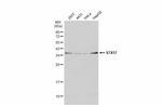 STX17 Antibody in Western Blot (WB)