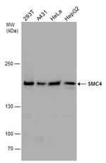 SMC4 Antibody in Western Blot (WB)