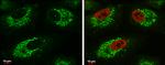 Glutaminase C (GAC) Antibody in Immunocytochemistry (ICC/IF)