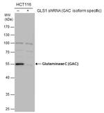 Glutaminase C (GAC) Antibody in Western Blot (WB)