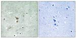 Phospho-RIP2 (Ser176) Antibody in Immunohistochemistry (Paraffin) (IHC (P))