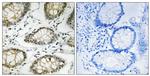 Phospho-ATR (Ser428) Antibody in Immunohistochemistry (Paraffin) (IHC (P))