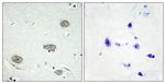 Phospho-CSF1R (Tyr809) Antibody in Immunohistochemistry (Paraffin) (IHC (P))