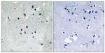 Phospho-SRF (Ser77) Antibody in Immunohistochemistry (Paraffin) (IHC (P))