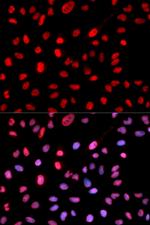 Phospho-DNMT1 (Ser714) Antibody in Immunocytochemistry (ICC/IF)