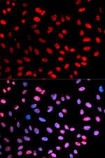 Phospho-Separase (Ser1126) Antibody in Immunocytochemistry (ICC/IF)