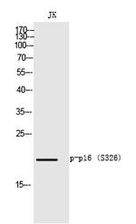 Phospho-p16INK4a (Ser152) Antibody in Western Blot (WB)