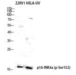 Phospho-p16INK4a (Ser152) Antibody in Western Blot (WB)