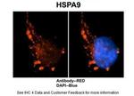 HSPA9 Antibody in Immunohistochemistry (IHC)