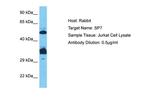 SP7 Antibody in Western Blot (WB)