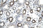 FOXF2 Antibody in Immunohistochemistry (IHC)