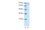 KDM2A Antibody in Western Blot (WB)