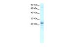 Nkx2.8 Antibody in Western Blot (WB)