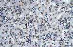 AATF Antibody in Immunohistochemistry (IHC)