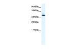 AATF Antibody in Western Blot (WB)