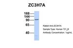 ZC3H7A Antibody in Western Blot (WB)