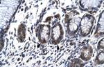 HCLS1 Antibody in Immunohistochemistry (Paraffin) (IHC (P))