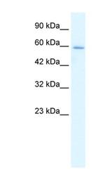 HCLS1 Antibody in Western Blot (WB)