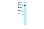 HCLS1 Antibody in Western Blot (WB)