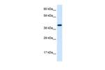 IA-1 Antibody in Western Blot (WB)