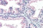 NAB1 Antibody in Immunohistochemistry (IHC)