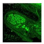 Neurogenin 1 Antibody in Immunohistochemistry (IHC)