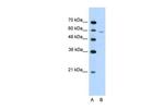 IRX4 Antibody in Western Blot (WB)