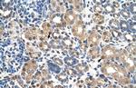 PBX3 Antibody in Immunohistochemistry (IHC)