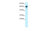 RNF12 Antibody in Western Blot (WB)