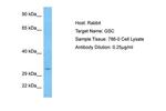 GSC Antibody in Western Blot (WB)