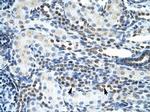 GSX2 Antibody in Immunohistochemistry (IHC)