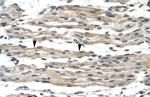 FOXL1 Antibody in Immunohistochemistry (IHC)