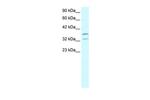 FOXL1 Antibody in Western Blot (WB)