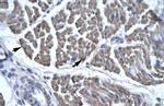 EYA3 Antibody in Immunohistochemistry (IHC)