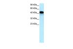 EYA3 Antibody in Western Blot (WB)