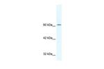 TLE3 Antibody in Western Blot (WB)