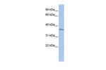 SIX3 Antibody in Western Blot (WB)