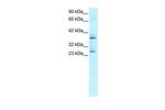 SIRT5 Antibody in Western Blot (WB)