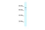 COLEC12 Antibody in Western Blot (WB)