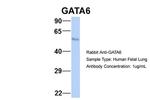 GATA6 Antibody in Western Blot (WB)